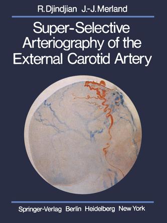 Super-Selective Arteriography of the External Carotid Artery