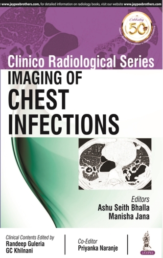Clinico Radiological Series: Imaging of Chest Infections
