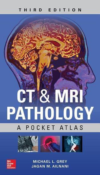 CT MRI PATHOLOGY A POCKET ATLAS THIRD ED