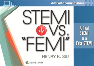 STEMI vs. FEMI