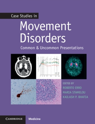 Case Studies in Neurology Case Studies in Neurology