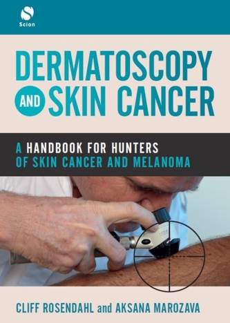 Dermatoscopy and Skin Cancer Dermatoscopy and Skin Cancer