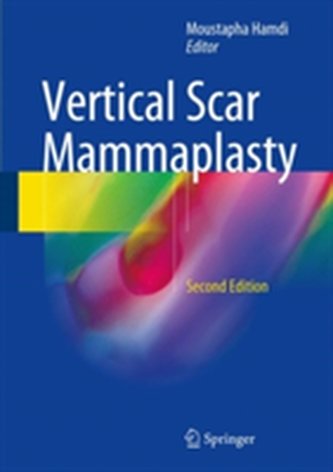 Vertical Scar Mammaplasty