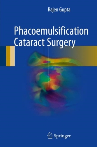 Phacoemulsification Cataract Surgery Phacoemulsification Cataract Surgery