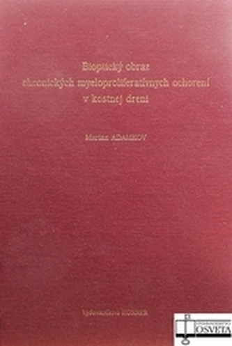 Bioptický obraz chronických myeloproliferatívnych ochorení v kostnej dreni 10%