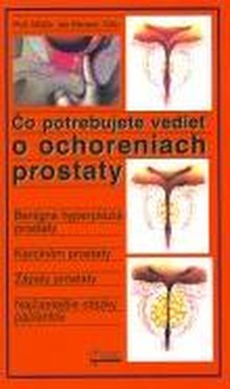 Čo potrebujete vedieť o ochoreniach prostaty Čo potrebujete vedieť o ochoreniach prostaty