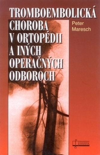Tromboembolická choroba v ortopédii a iných operačných odboroch Tromboembolická choroba v ortopédii a iných operačných odboroch