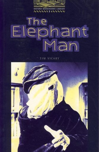 The Elephant Man