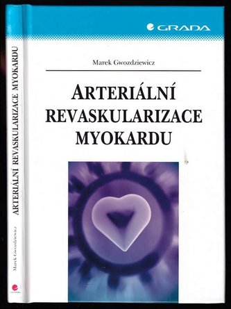 Arteriální revaskularizace myokardu