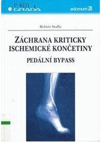 Záchrana kriticky ischemické končetiny (pedální bypass)