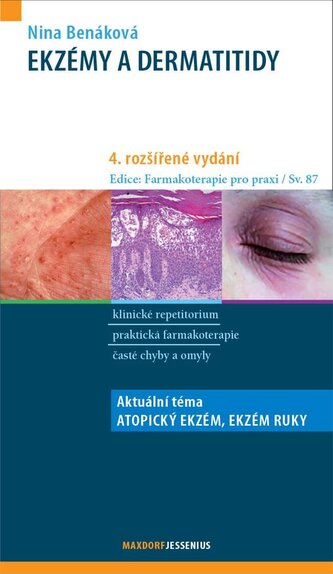 Ekzémy a dermatitidy, 4. rozšířené a aktualizované vydání