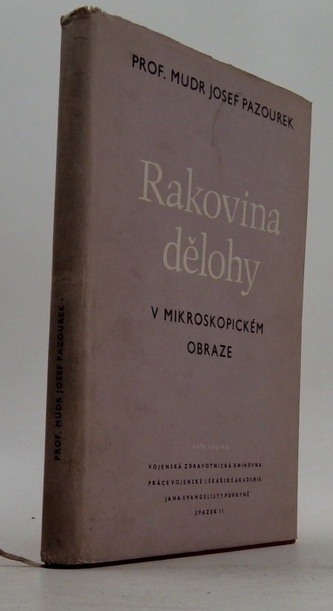 Rakovina dělohy v mikroskopickém obraze