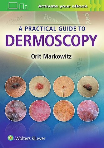 Markowitz, O: Practical Guide to Dermoscopy