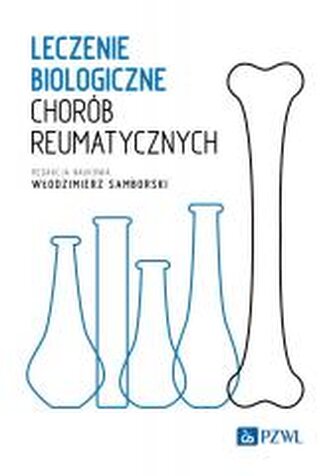 Leczenie biologiczne chorób reumatycznych