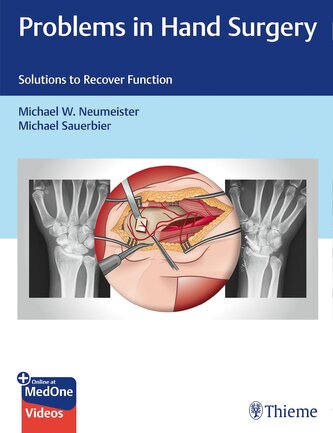 Problems in Hand Surgery Problems in Hand Surgery
