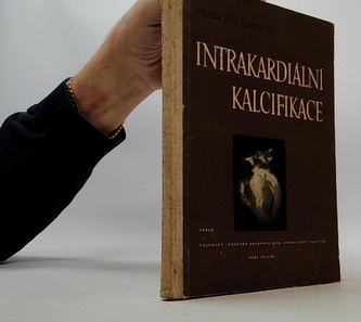 Intrakardiální kalcifikace