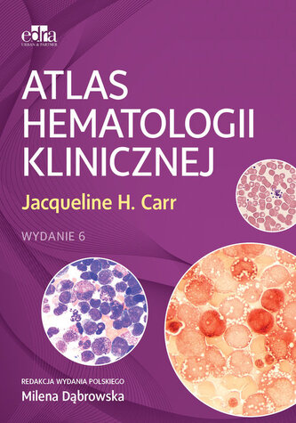 Atlas hematologii klinicznej