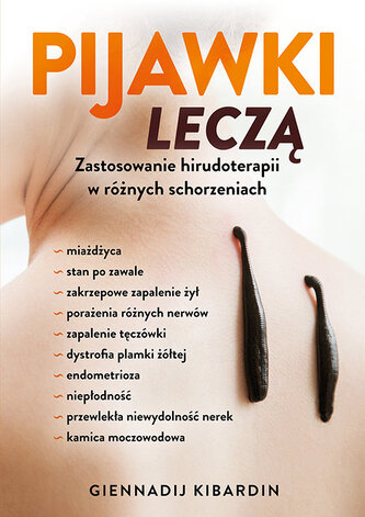 Pijawki leczą