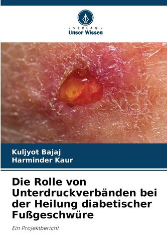 Die Rolle von Unterdruckverbänden bei der Heilung diabetischer Fußgeschwüre