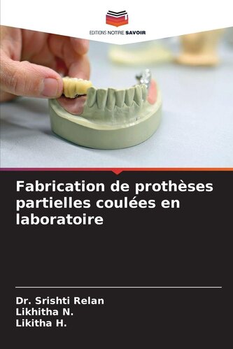 Fabrication de prothèses partielles coulées en laboratoire