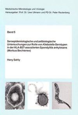 Seroepidemiologische und zellbiologische Untersuchungen zur Rolle von Klebsiella-Serotypen in der HLA-B27-assoziierten Spondylit