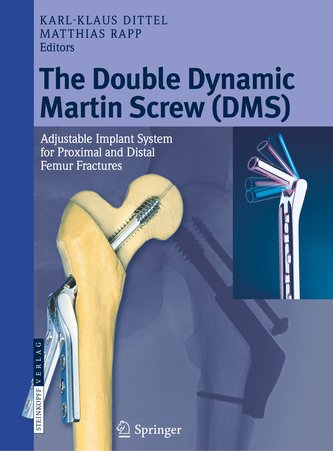 The Double Dynamic Martin Screw (DMS)