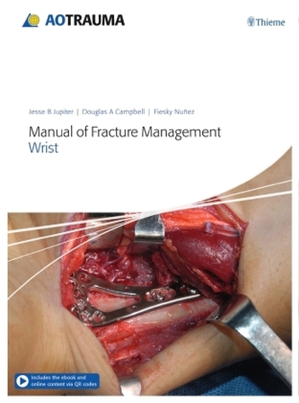 Manual of Fracture Management - Wrist, m. 1 Buch, m. 1 E-Book Manual of Fracture Management - Wrist, m. 1 Buch, m. 1 E-Book