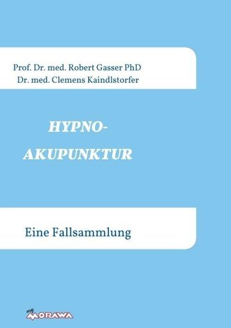 Hypnoakupunktur