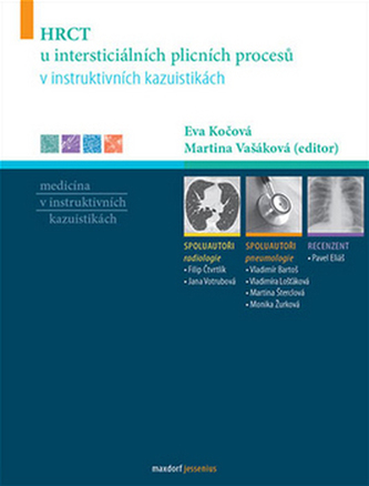 HRCT u intersticiálních plicních procesů v instruktivních kazuistikách
