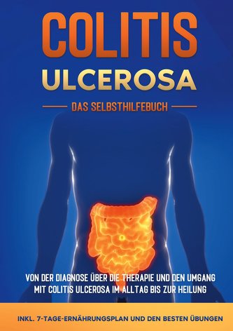 Colitis ulcerosa - Das Selbsthilfebuch: Von der Diagnose über die Therapie und den Umgang mit Colitis ulcerosa im Alltag bis zur