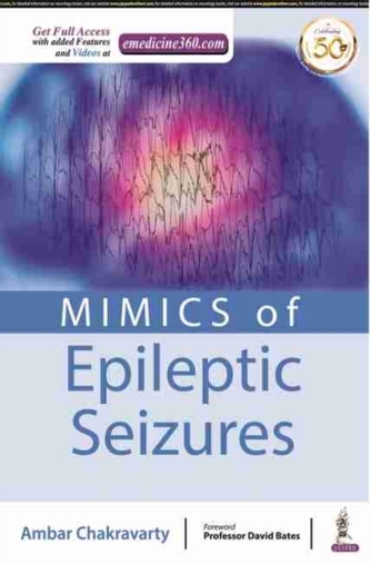 MIMICS of Epileptic Seizures MIMICS of Epileptic Seizures