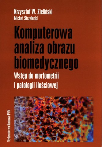 Komputerowa analiza obrazu biomedycznego