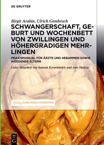 Zwillings- oder Mehrlingsschwangerschaft und -Geburt