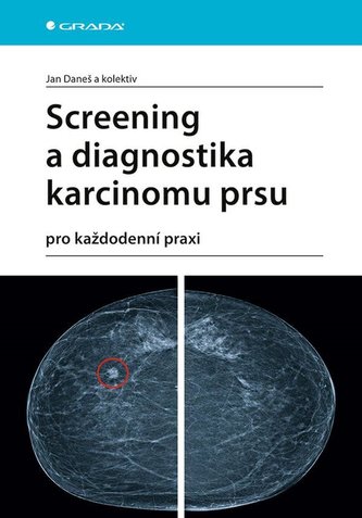 Screening a diagnostika karcinomu prsu : pro každodenní praxi (Jan Daneš, 2021)