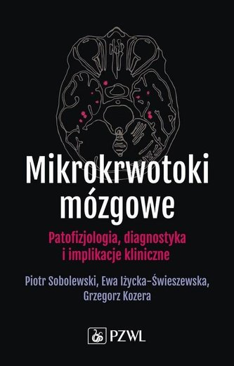 Mikrokrwotoki mózgowe