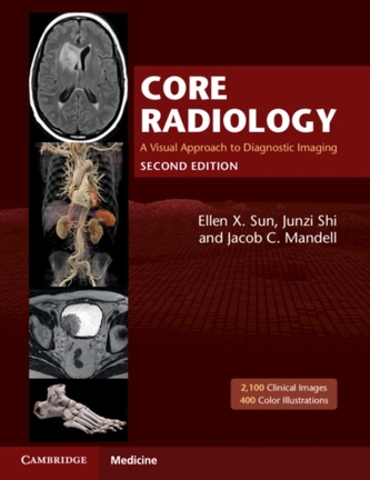 Core Radiology / volume 1 + volume 2