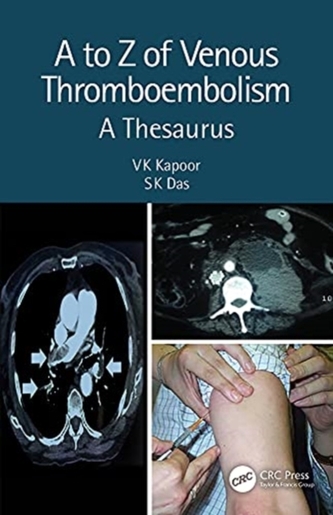 A to Z of Venous Thromboembolism