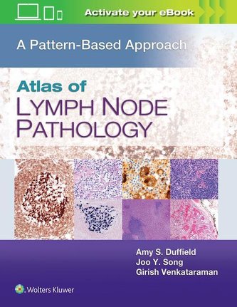 Atlas of Lymph Node Pathology