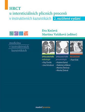 HRCT u intersticiálních plicních procesů v instruktivních kazuistikách