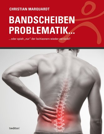Bandscheiben Problematik