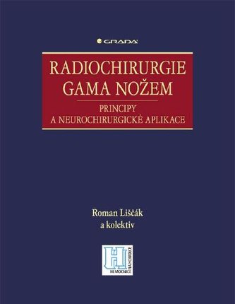 Radiochirurgie gama nožem