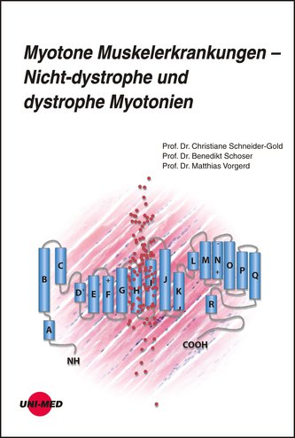 Myotone Muskelerkrankungen - Nicht-dystrophe und dystrophe Myotonien