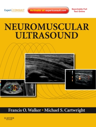 Neuromuscular Ultrasound Neuromuscular Ultrasound