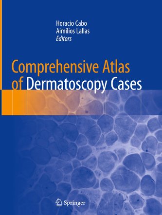 Comprehensive Atlas of Dermatoscopy Cases