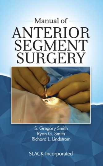 Manual of Anterior Segment Surgery Manual of Anterior Segment Surgery