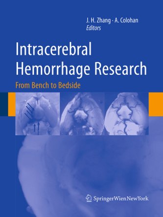 Intracerebral Hemorrhage Research