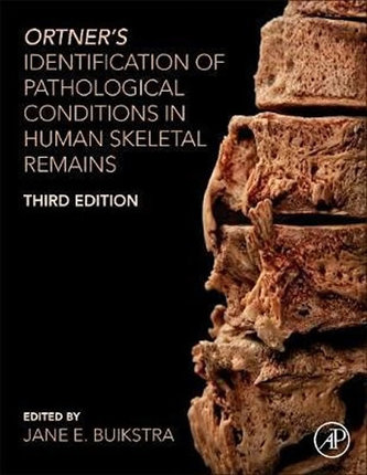 Ortner´s Identification of Pathological Conditions in Human Skeletal Remains