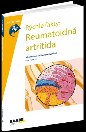 Rýchle fakty: Reumatoidná artritída