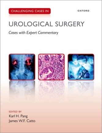 Challenging Cases in Urological Surgery Challenging Cases in Urological Surgery
