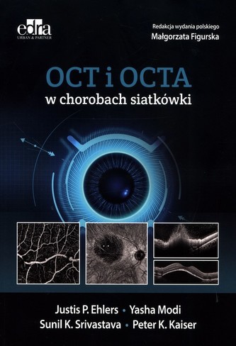 OCT i OCTA w chorobach siatkówki